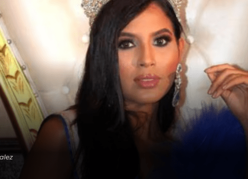 Fallece modelo venezolana tras cirugía maxilofacial