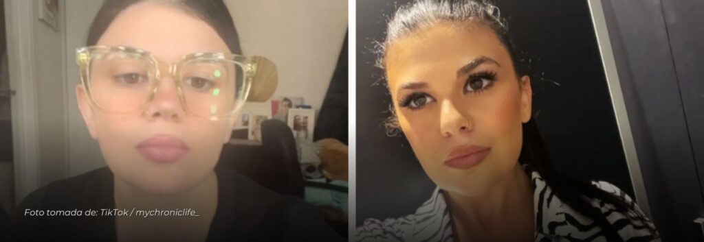 Mujer australiana fue al médico por dolor abdominal y los médicos encontraron 5 órganos de más en su cuerpo