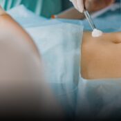 Clausuran spa en Supía tras liposucción clandestina que dejó a joven de 26 años en delicado estado