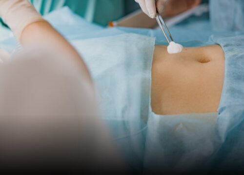 Clausuran spa en Supía tras liposucción clandestina que dejó a joven de 26 años en delicado estado