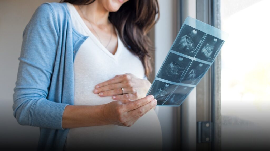 Caen los nacimientos en Colombia en 2025, aunque se desacelera la tendencia a la baja