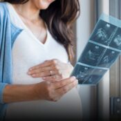 Caen los nacimientos en Colombia en 2025, aunque se desacelera la tendencia a la baja