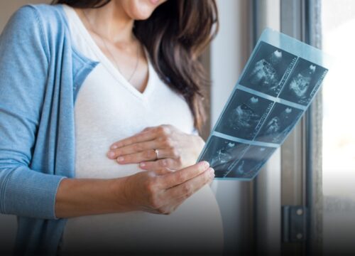 Caen los nacimientos en Colombia en 2025, aunque se desacelera la tendencia a la baja