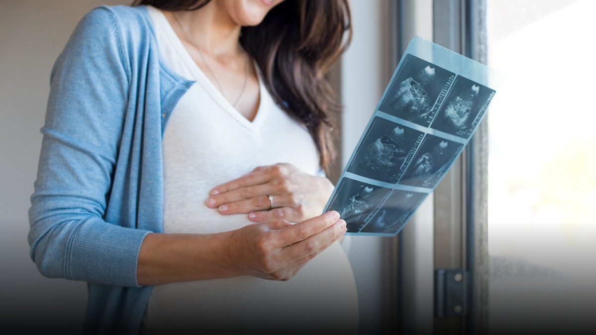 Caen los nacimientos en Colombia en 2025, aunque se desacelera la tendencia a la baja