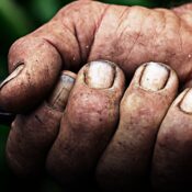 Capturan a hombre de Caldas por brutal ataque a su pareja en Huila; la víctima perdió una mano